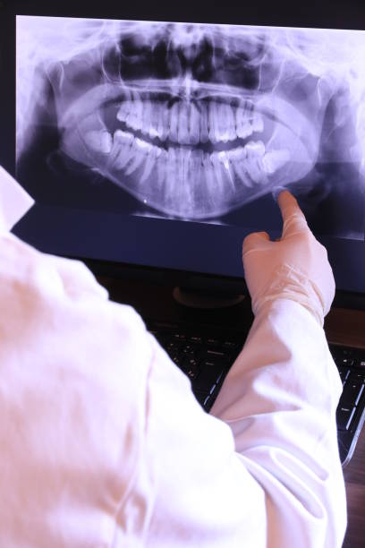 Best Walk-In Emergency Dental Services in Burlingame, CA