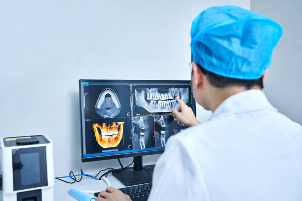 Best Knocked-Out Tooth (Avulsed Tooth) Treatment in Burlingame, CA