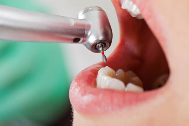 Best Emergency Pediatric Dental Care in Burlingame, CA